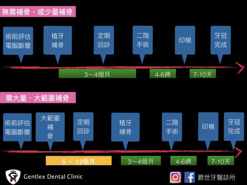 植牙完成要等多久呢？