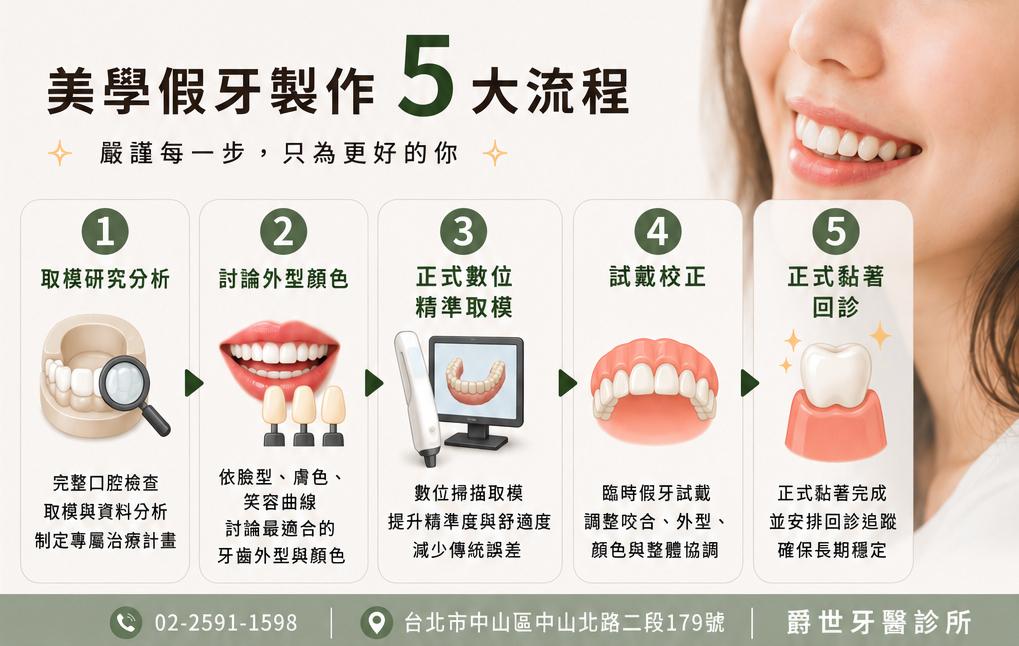 美學假牙製作5大流程