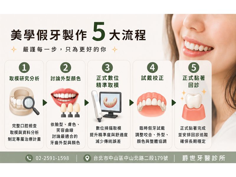 美學假牙製作5大流程