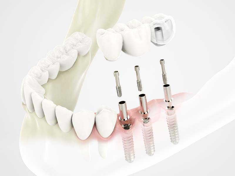 假牙專科醫師在想什麼？