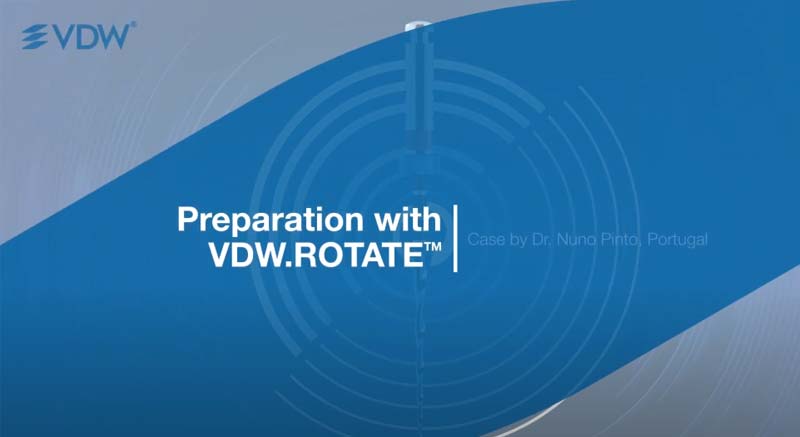 高效根管治療步驟