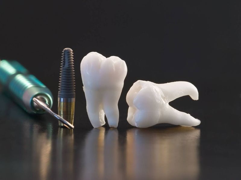 植⽛品牌排名⼤廠共通點有哪些？